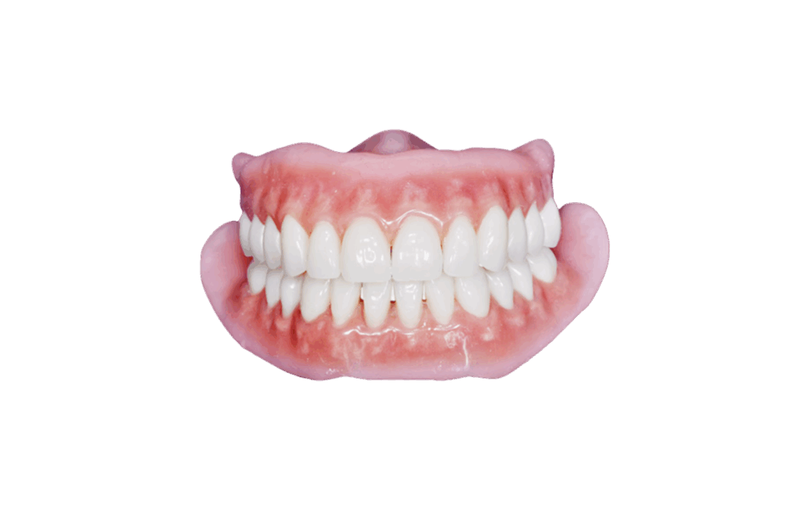 BPS svájci kivehető fogsor – a természetes mosoly prémium megoldása