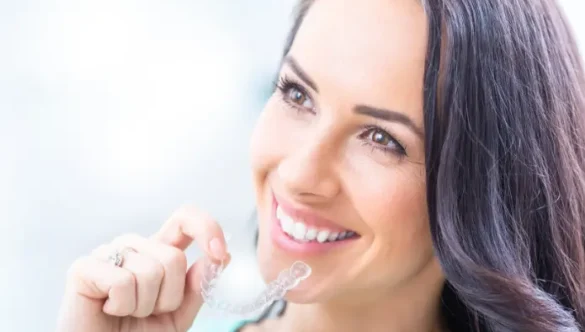 Láthatatlan fogszabályzó, a diszkrét megoldás