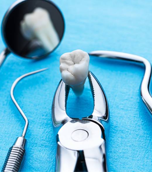 sebeszi_fogeltavolitas